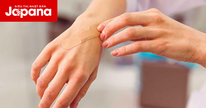 5 mẹo giúp mau lành sẹo đơn giản hiệu quả