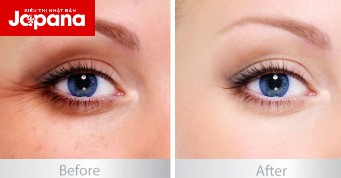Tuyệt chiêu xóa nếp nhăn bằng lòng trắng trứng