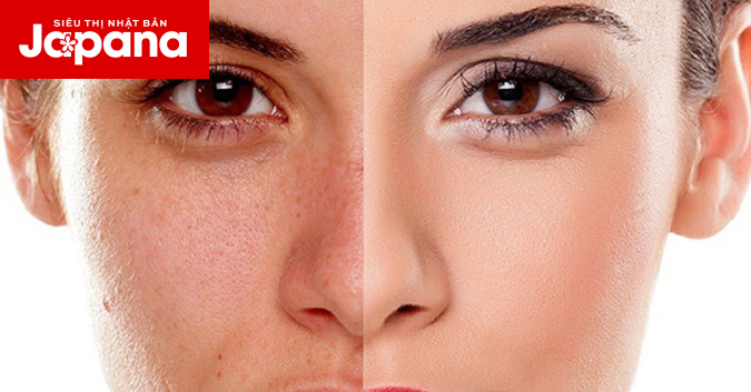 Nguyên nhân và cách điều trị bệnh sạm da