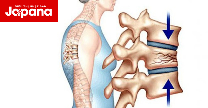 Các vấn đề dinh dưỡng về bệnh loãng xương