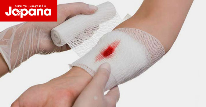 10 mẹo giúp vết thương mau lành tại nhà cực đơn giản