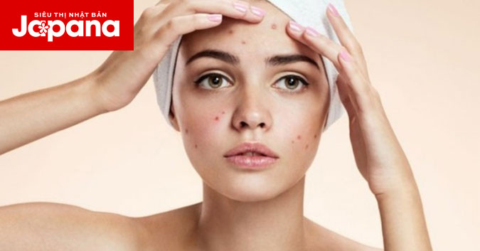 Da mụn ngày càng trở nên tệ hại vì những thói quen này
