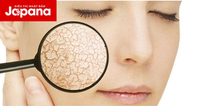 3 điều quan trọng cần lưu ý khi chăm sóc da khô