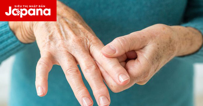 Những biểu hiện của bệnh viêm khớp dạng thấp