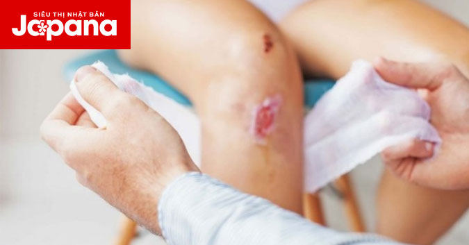 Bị vết thương hở không nên ăn gì?