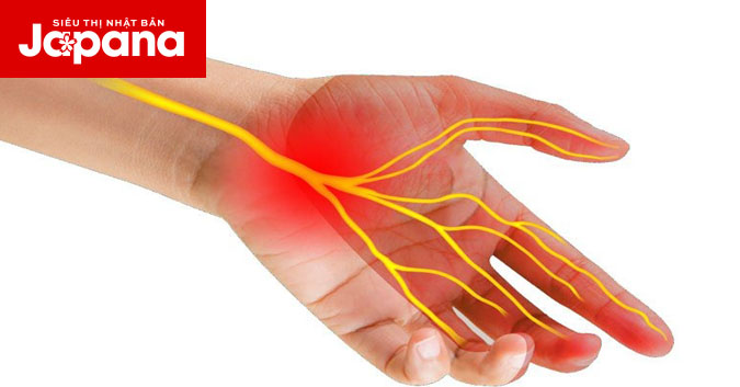 Nguyên nhân và cách điều trị hội chứng ống cổ tay