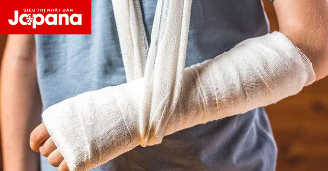 Hướng dẫn sơ cứu gãy xương nhanh chóng và an toàn