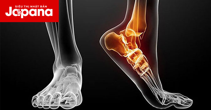 Phương pháp bó thuốc gia truyền điều trị trật khớp có hiệu quả như lời đồn