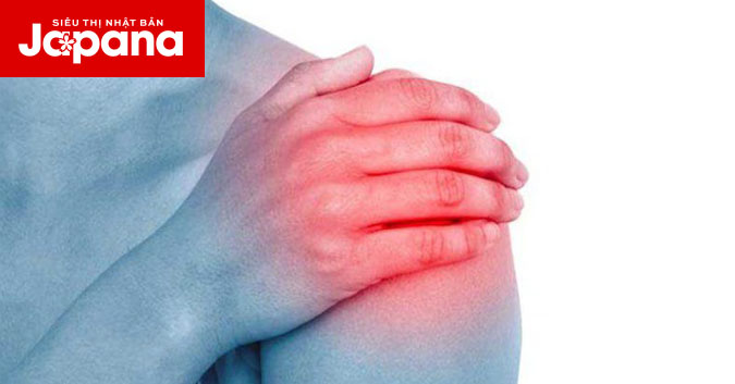 Những điều bạn cần biết về viêm quanh khớp vai