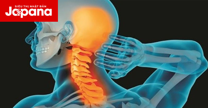 Những điều bạn cần biết về thoái hoá cột sống cổ