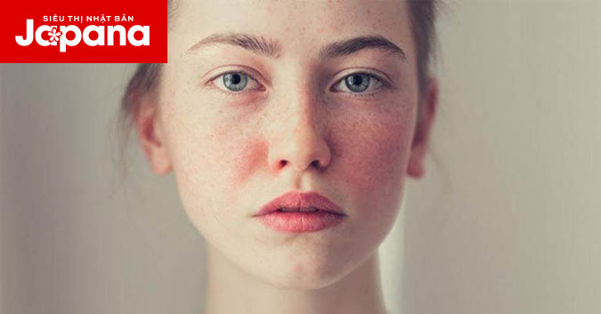 Làm trắng da tại nhà và những sai lầm tai hại