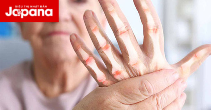 5 dấu hiệu bệnh xương khớp thường gặp phải