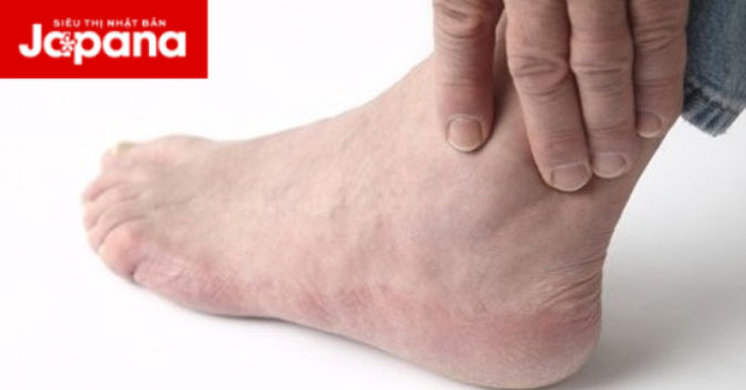 Đau khớp cổ chân là biểu hiện của bệnh gì và có nguy hiểm hay không?