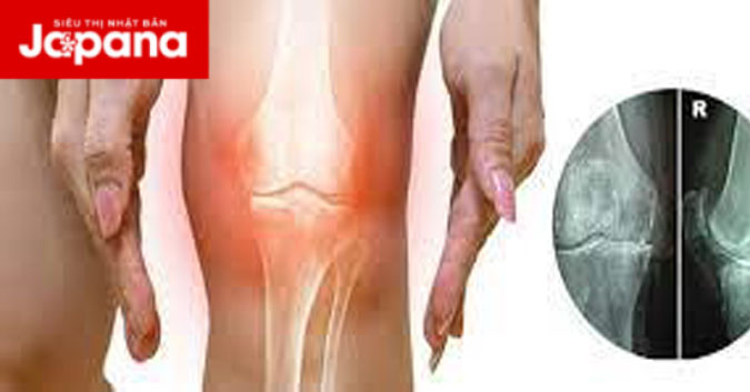 Hẹp khe khớp gối nguy hiểm như thế nào?