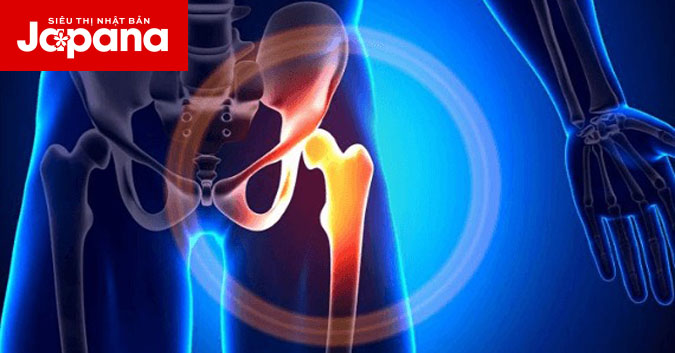Nguyên nhân gây đau khớp háng ở phụ nữ và cách điều trị theo nguyên nhân