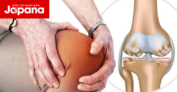 5 nguyên nhân chính dẫn đến thoái hoá khớp gối