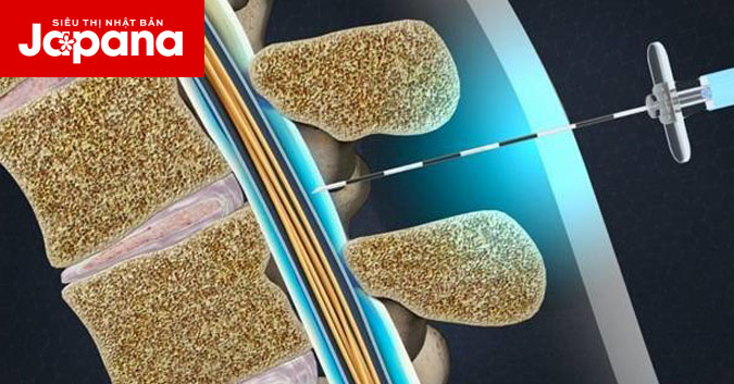 Hậu quả của việc lạm dụng thuốc tiêm chữa viêm khớp