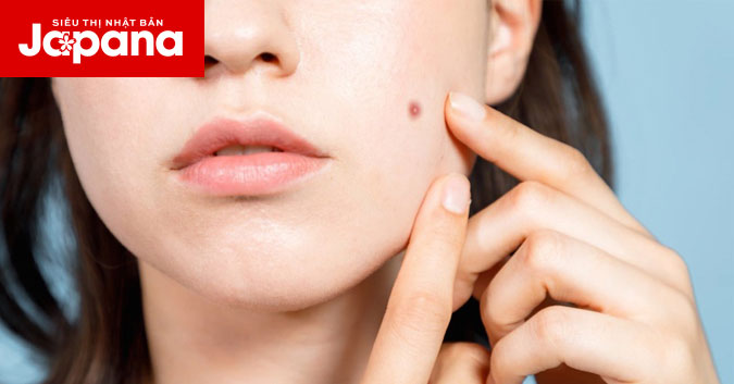 Bật mí bí quyết trị mụn cho từng độ tuổi