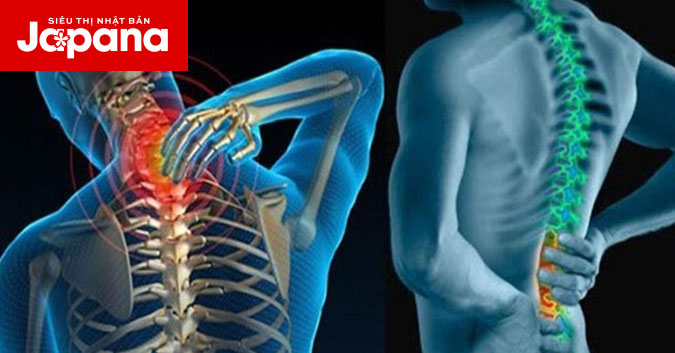 4 chứng bệnh cột sống thường gặp ở người trưởng thành