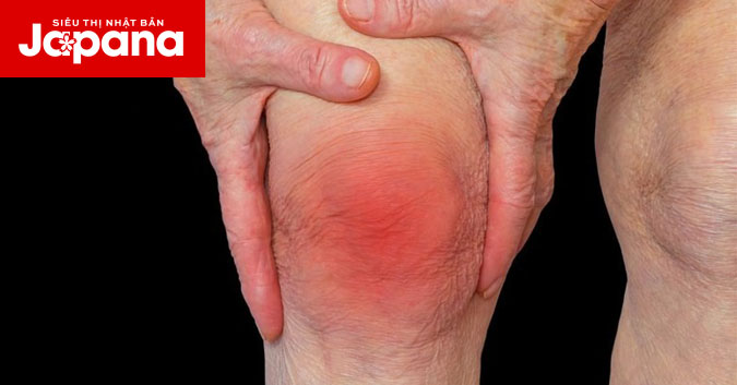 Những dấu hiệu cảnh báo khớp bị viêm