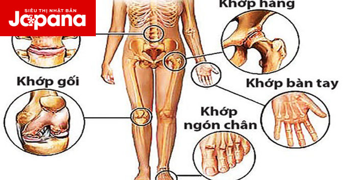 Những điều bạn cần biết về hệ thống xương khớp
