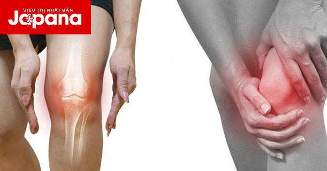 Trị khỏi khớp gối viêm đau nhanh hay chậm là do bạn 