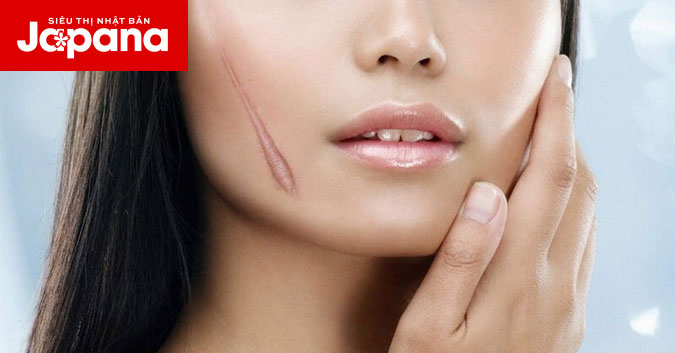 Làm sao để điều trị sẹo đúng cách?
