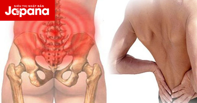 Đau lưng dưới cảnh báo 6 bệnh xương khớp gây nguy hiểm