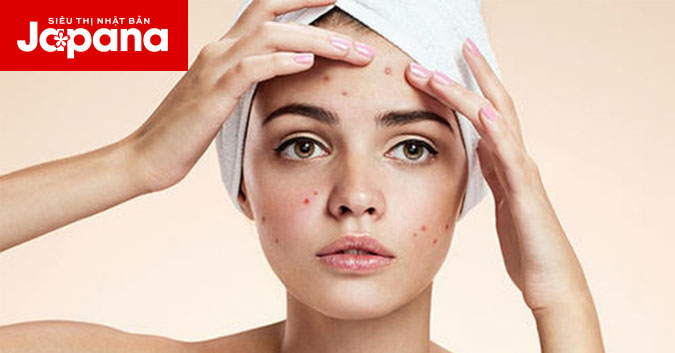 Nên thay đổi cách chăm sóc da vào những thời điểm nào?