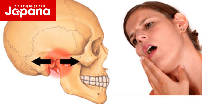 Nguyên nhân viêm khớp thái dương hàm và cách điều trị