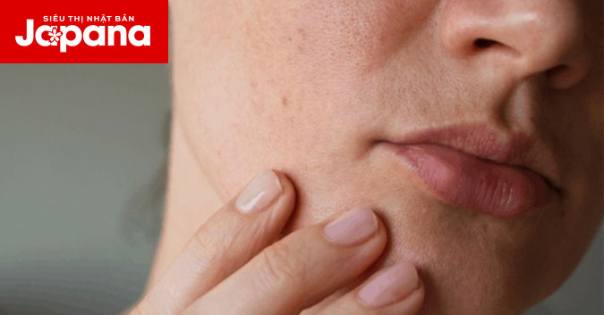 6 dấu hiệu cảnh báo bạn nên chăm sóc cho làn da của mình