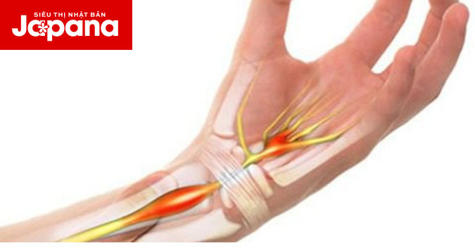 Những nguyên nhân thường gặp dẫn đến đau khớp cổ tay