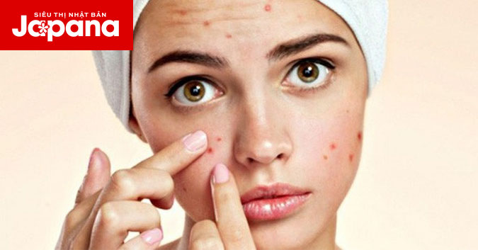 Những thói quen làm hại nhan sắc mà bạn cần biết