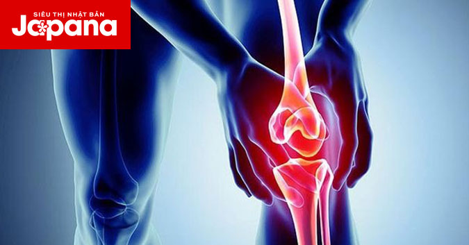 Cảnh báo 5 dấu hiệu viêm khớp đầu gối không nên chủ quan