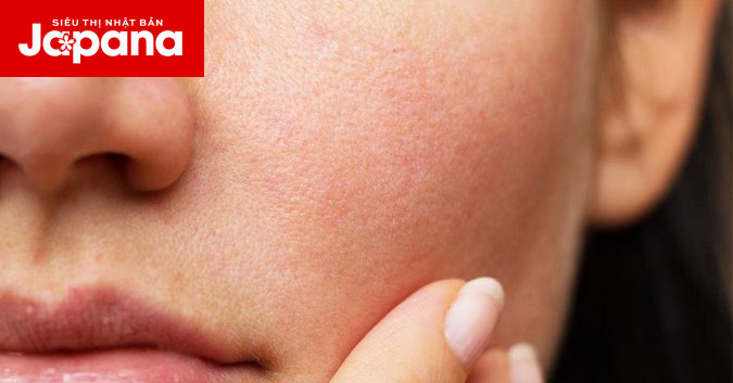 Da mặt khô ráp dù đã dùng phương pháp dưỡng da cẩn thận, nguyên nhân do đâu?