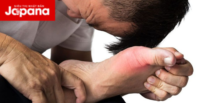 Đối tượng nào dễ mắc bệnh gout và lời khuyên hữu ích cho người bị gout