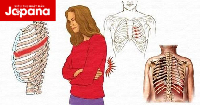 Cảnh báo nhiều bệnh lý nguy hiểm gây đau xương sườn
