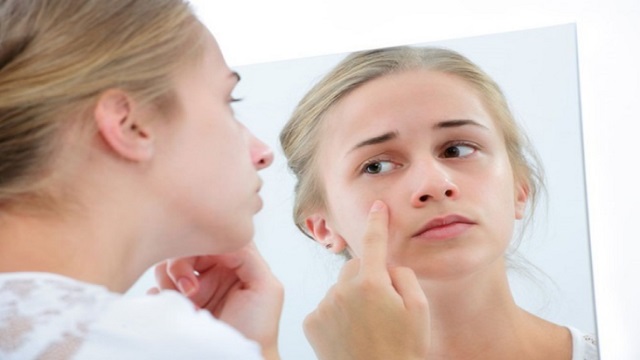 5 thói quen xấu có thể giết chết làn da của bạn