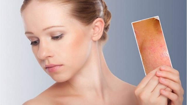 Mách bạn 5 bước chăm sóc da dầu đơn giản và hiệu quả