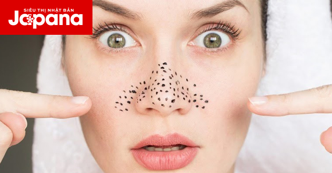 4 tuyệt chiêu trị mụn đầu đen đơn giản tại nhà không thể bỏ qua