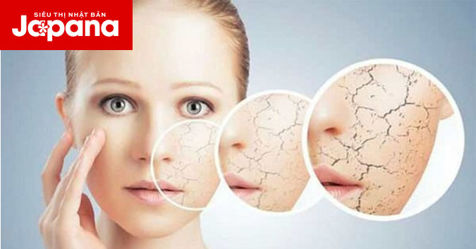 8 điều cần lưu ý khi chăm sóc da khô