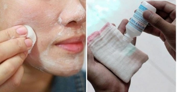 Mách bạn công thức làm trắng da từ oxy già