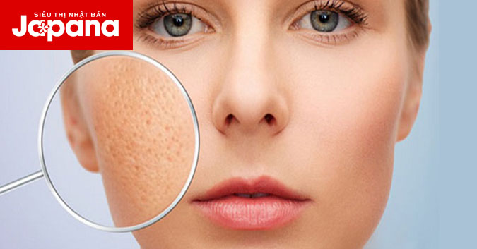 Mẹo làm se khít lỗ chân lông ở mặt đơn giản tại nhà