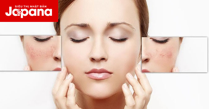 Điểm qua những thủ phạm khiến da mặt bạn xấu đi
