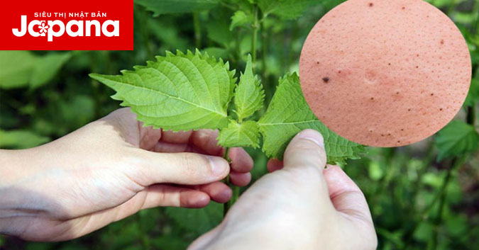 Trị mụn đầu đen bằng lá tía tô có hiệu quả không?