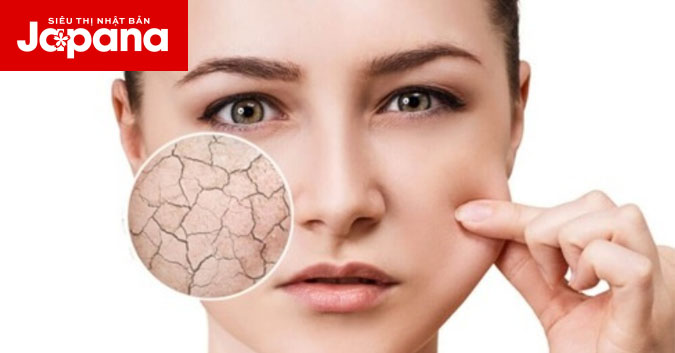 Bổ sung collagen dưỡng ẩm cho da khô là điều cần thiết
