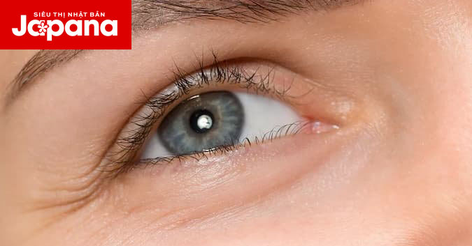 Làm sao để cải thiện nếp nhăn vùng da quanh mắt ở độ tuổi 30?