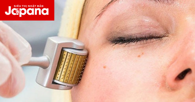 Lăn Kim Trị Nám Được Không? Làm Sao Để Lăn Kim Hiệu Quả