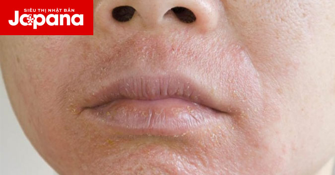 Cải thiện da bị khô từng mảng ở tuổi 40 từ trong ra ngoài