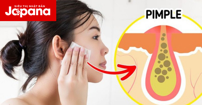 10 thói quen gây hại cho da hằng ngày mà bạn cần biết